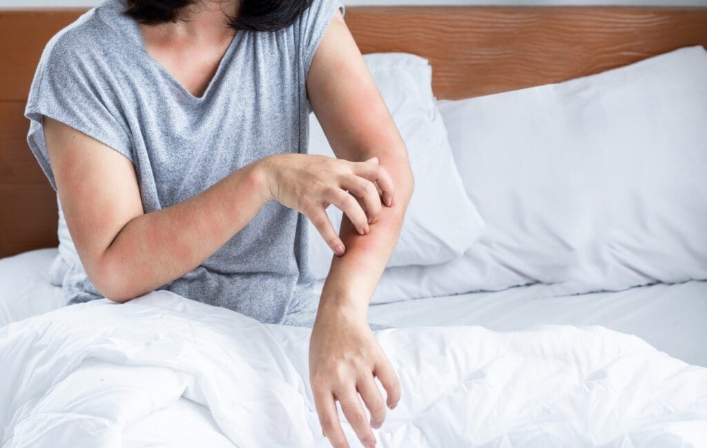 Acariens dans la literie : comment éviter les allergies
