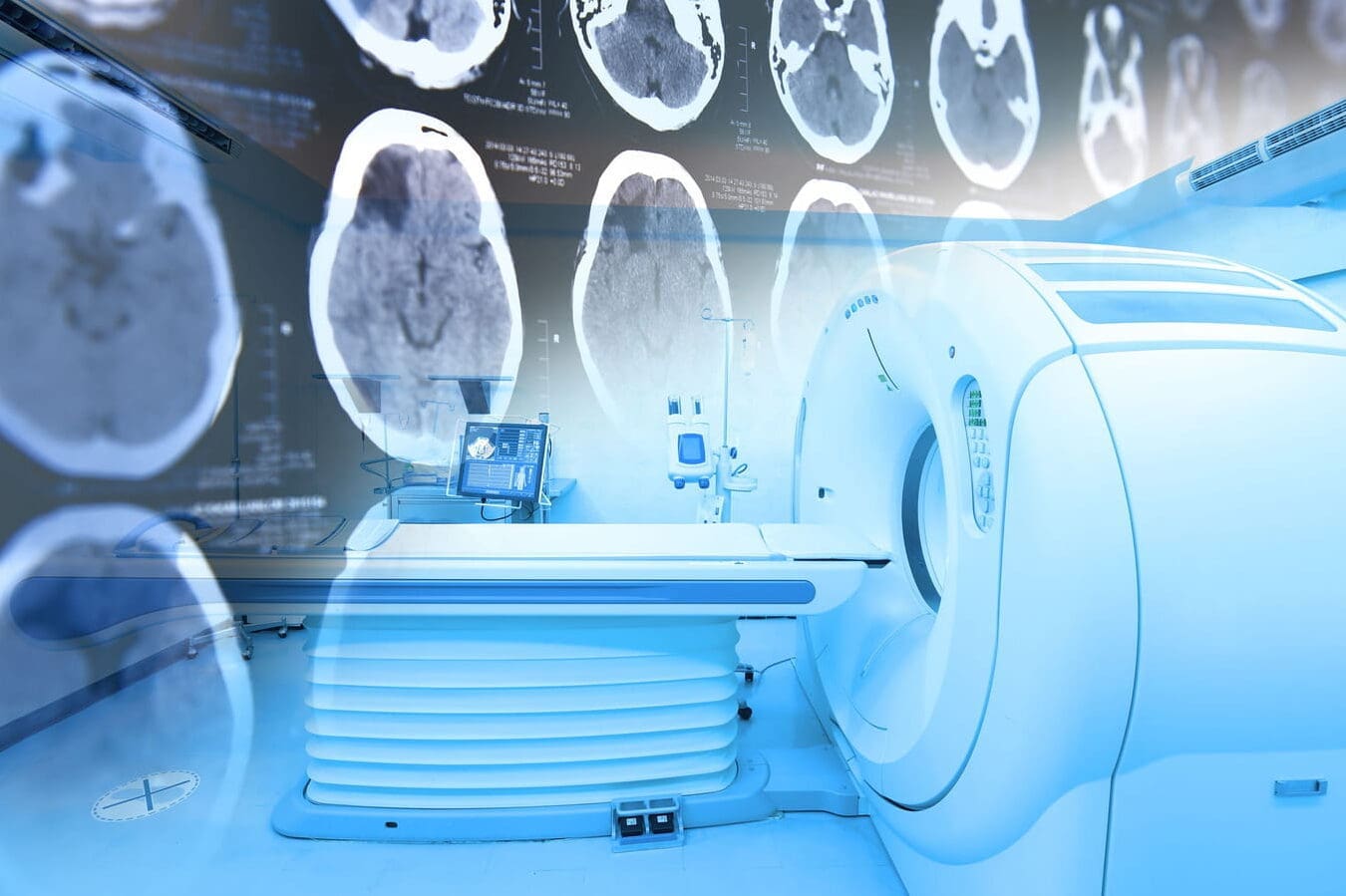 La Myélinolyse Centre-Pontine: Comprendre et Prévenir cette Affection Neurologique Rare