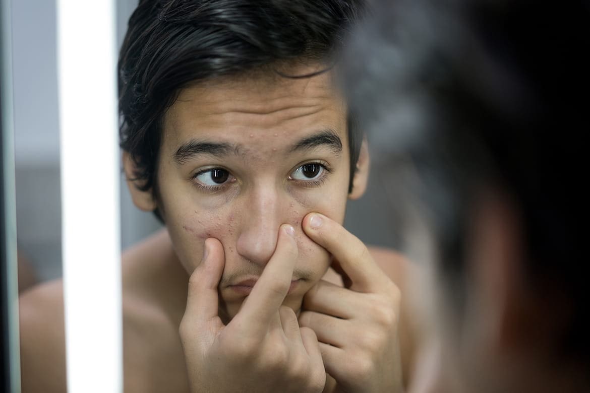 Conseils de soins de la peau recommandés par les dermatologues pour les adolescents et les jeunes adultes